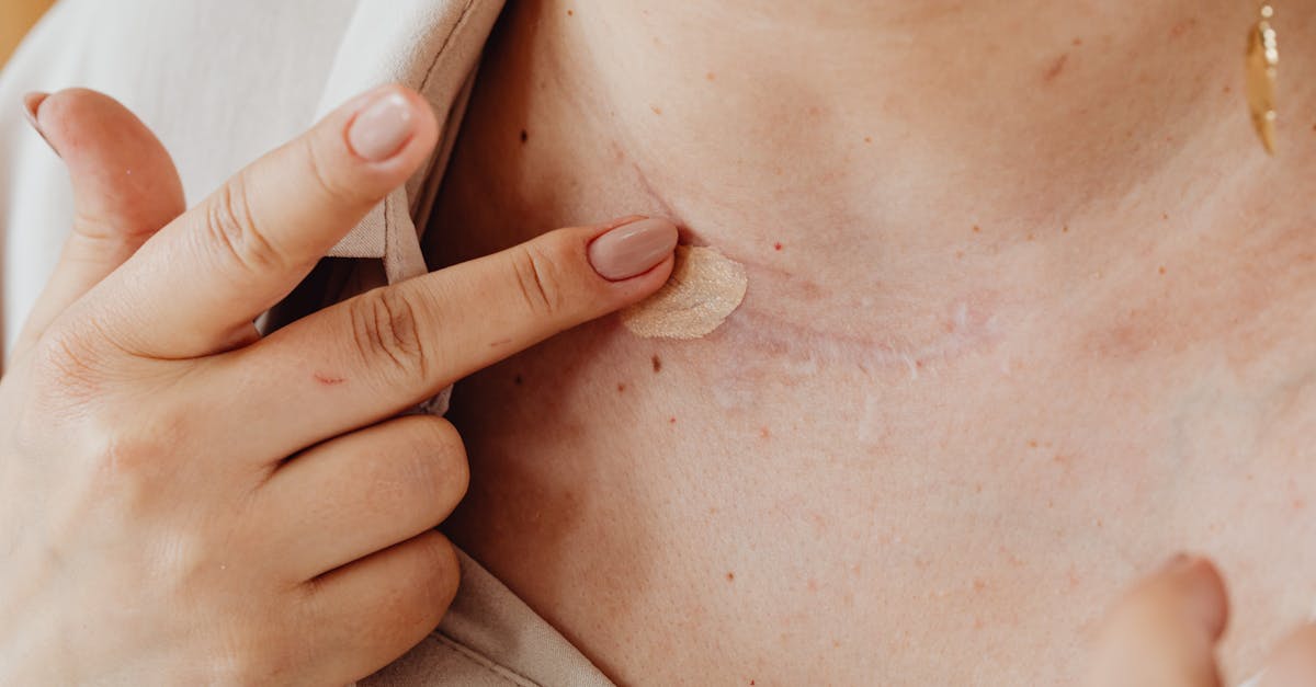 a person applies concealer on a neck scar with manicured nails in a close up shot